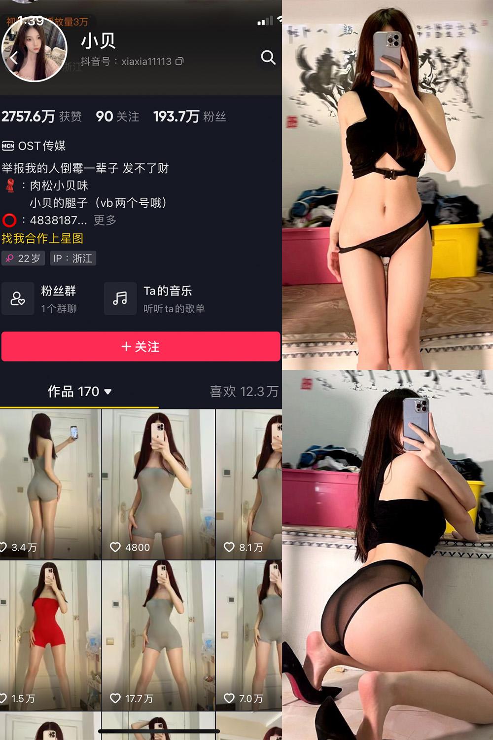 抖音 小贝 VIP 微密圈  NO.003期 【32P】