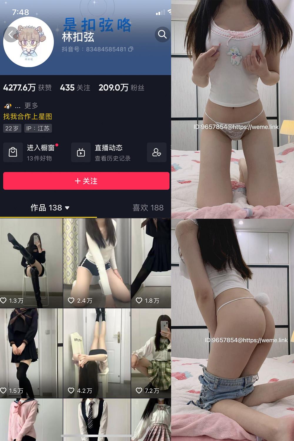 抖音 林扣弦 微密圈 NO.070期 【25P】最新至：2024.9.25
