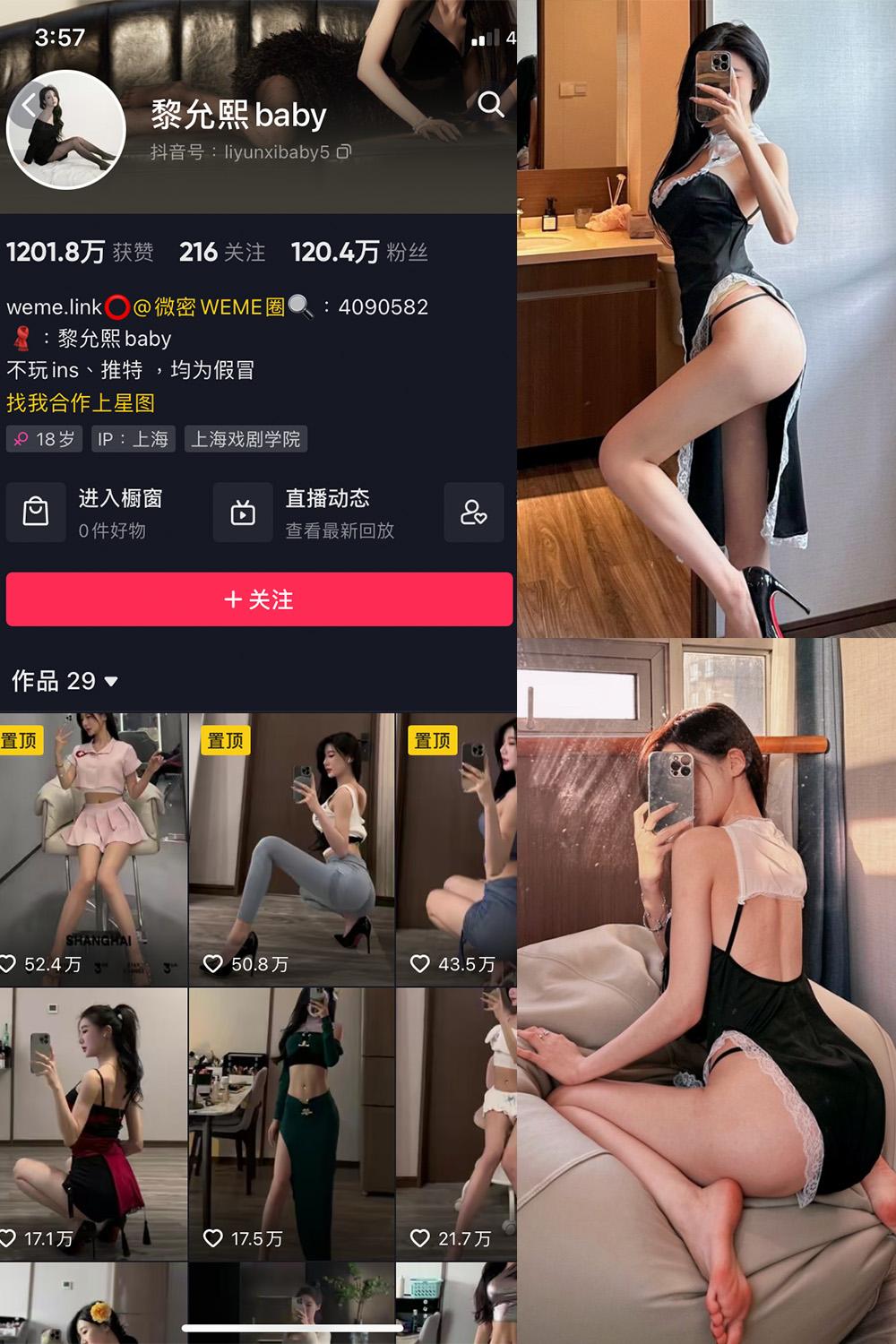 抖音 黎允熙baby 微密圈  NO.023期 【22P】