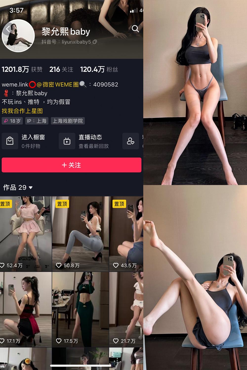 抖音 黎允熙baby 微密圈  NO.019期 【24P】