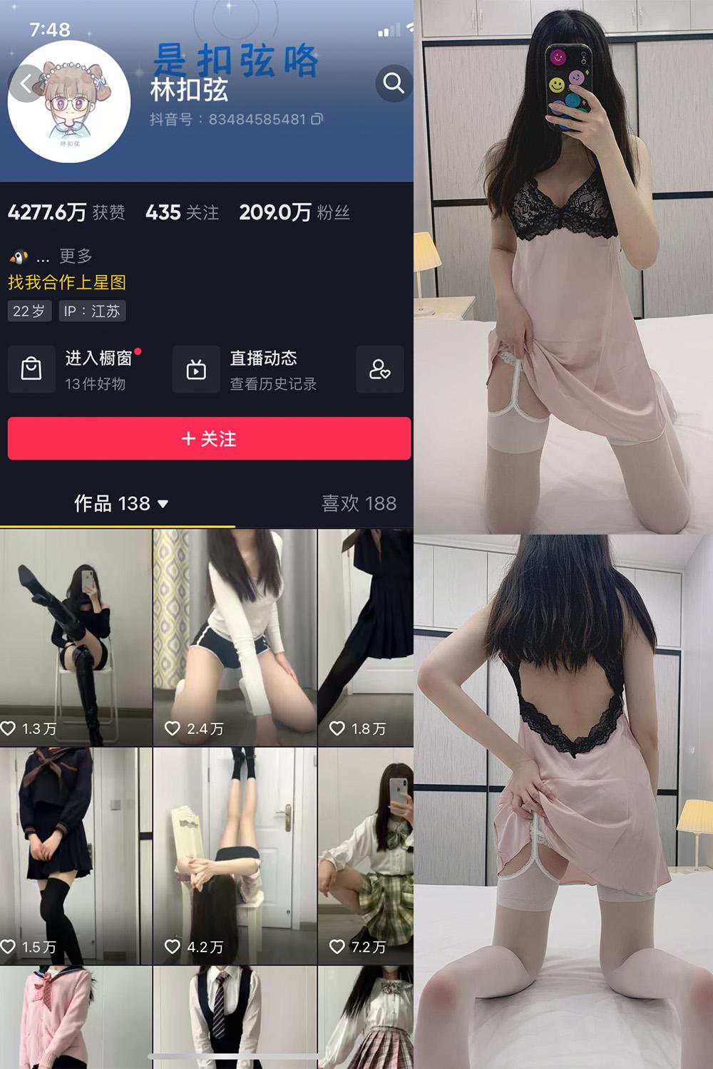 抖音 林扣弦 微密圈  NO.031期 【32P】