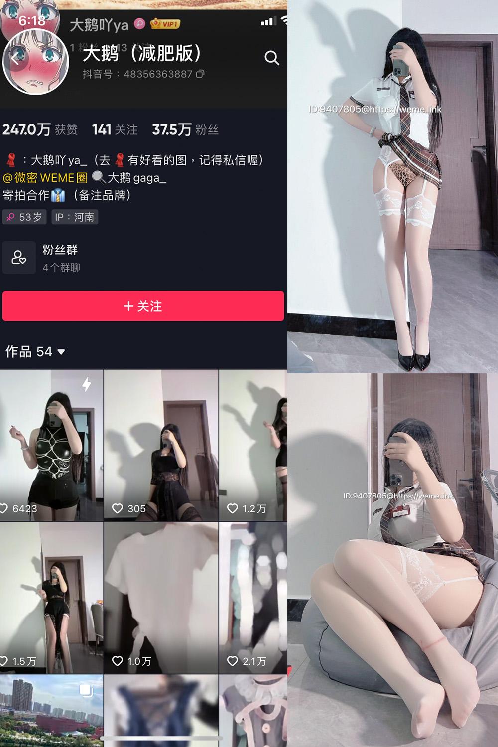 抖音 大鹅gaga 微密圈  NO.005期 【15P】